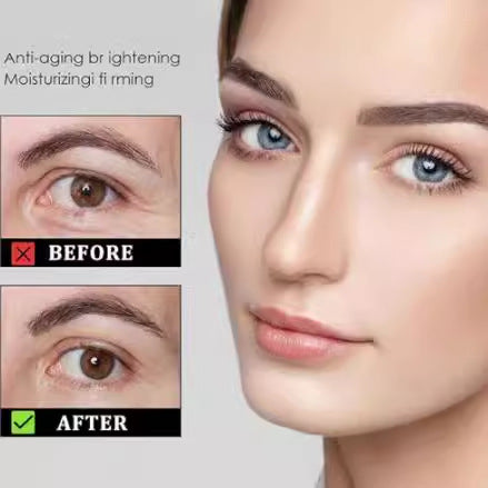 Roller Ball Under Eyes Eye Care